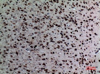 Fig.5. Immunohistochemical analysis of paraffin-embedded Mouse-brain, antibody was diluted at 1:100.