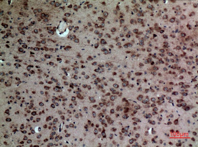 Fig.6. Immunohistochemical analysis of paraffin-embedded Mouse-brain, antibody was diluted at 1:100.