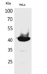 Fig.1. Western Blot analysis of hela cells using Cyclophilin D Polyclonal Antibody. Secondary antibody (catalog#: A21020) was diluted at 1:20000.