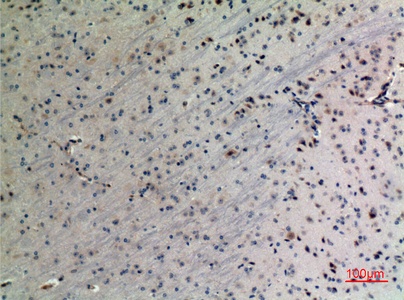 Fig.2. Immunohistochemical analysis of paraffin-embedded Mouse-brain, antibody was diluted at 1:100.
