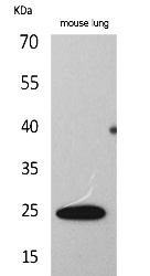 Fig. Western Blot analysis of Mouse lung cells using ET-1 Polyclonal Antibody. Secondary antibody (catalog#: A21020) was diluted at 1:20000.