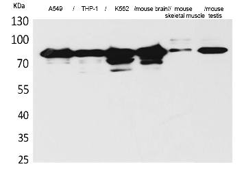 Fig.1. Western Blot analysis of A549, THP-1,  K562,  Mouse brain, Mouse skeletal muscle, Mouse testis cells using PKC γ Polyclonal Antibody. Secondary antibody (catalog#: A21020) was diluted at 1:20000.