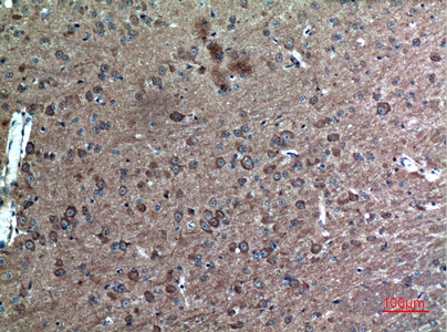 Fig.2. Immunohistochemical analysis of paraffin-embedded Mouse-brain, antibody was diluted at 1:100.