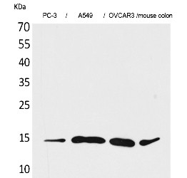 Fig.1. Western Blot analysis of PC-3, A549, OVCAR3, Mouse colon cells using Eotaxin-3 Polyclonal Antibody. Secondary antibody (catalog#: A21020) was diluted at 1:20000.
