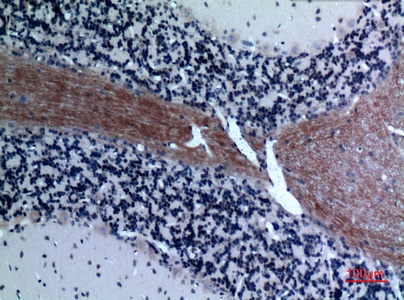 Fig.2. Immunohistochemical analysis of paraffin-embedded rat-brain, antibody was diluted at 1:100.