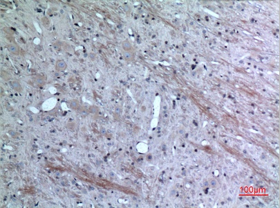 Fig.3. Immunohistochemical analysis of paraffin-embedded rat-brain, antibody was diluted at 1:100.