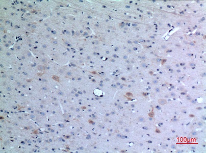 Fig.4. Immunohistochemical analysis of paraffin-embedded rat-brain, antibody was diluted at 1:100.