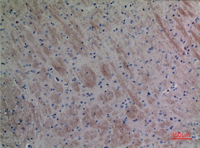 Fig.5. Immunohistochemical analysis of paraffin-embedded Mouse-brain, antibody was diluted at 1:100.