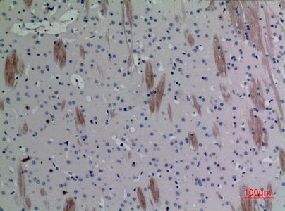 Fig.6. Immunohistochemical analysis of paraffin-embedded Mouse-brain, antibody was diluted at 1:100.