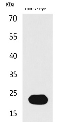 Fig.1. Western Blot analysis of Mouse eye cells using BNIP-3 Polyclonal Antibody. Secondary antibody (catalog#: A21020) was diluted at 1:20000.