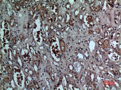 Fig.3. Immunohistochemical analysis of paraffin-embedded human-kidney, antibody was diluted at 1:100.