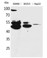 Fig. Western Blot analysis of SW480, SKOV3, HepG2 cells using c-FLIP Polyclonal Antibody. Secondary antibody (catalog#: A21020) was diluted at 1:20000.