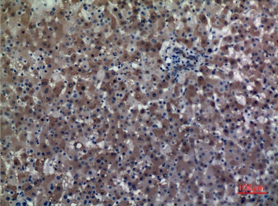 Fig.2. Immunohistochemical analysis of paraffin-embedded human-liver, antibody was diluted at 1:100.