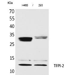 Fig. Western Blot analysis of H460, 293 cells using TFPI-2 Polyclonal Antibody. Secondary antibody (catalog#: A21020) was diluted at 1:20000.