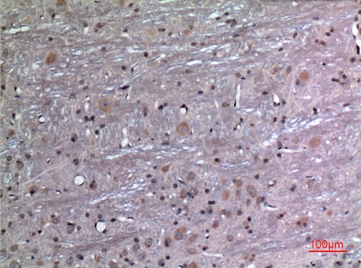 Fig.3. Immunohistochemical analysis of paraffin-embedded rat-brain, antibody was diluted at 1:100.
