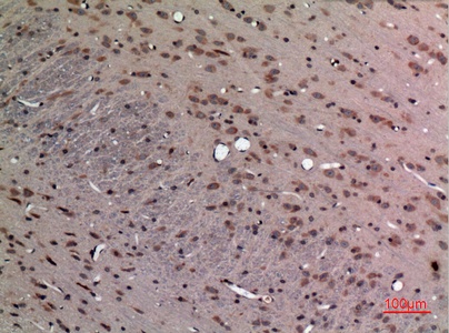 Fig.4. Immunohistochemical analysis of paraffin-embedded rat-brain, antibody was diluted at 1:100.
