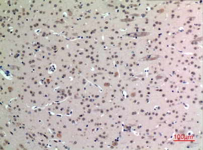 Fig.5. Immunohistochemical analysis of paraffin-embedded Mouse-brain, antibody was diluted at 1:100.