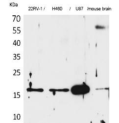 Fig.1. Western Blot analysis of 22RV-1,  H460, U87, Mouse brain cells using Apelin Polyclonal Antibody. Secondary antibody (catalog#: A21020) was diluted at 1:20000.