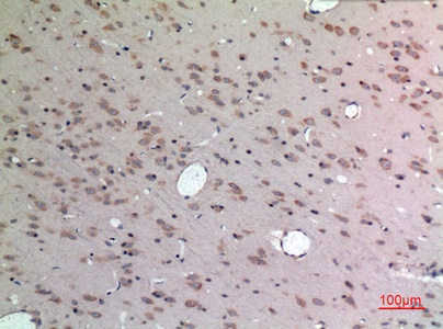 Fig.2. Immunohistochemical analysis of paraffin-embedded rat-brain, antibody was diluted at 1:100.