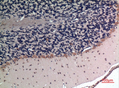 Fig.4. Immunohistochemical analysis of paraffin-embedded rat-brain, antibody was diluted at 1:100.