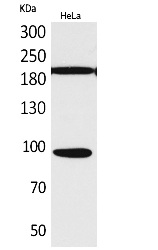 Fig. Western Blot analysis of hela cells using Trk C Polyclonal Antibody. Secondary antibody (catalog#: A21020) was diluted at 1:20000.