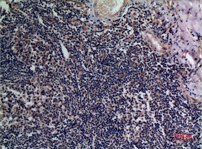 Fig.2. Immunohistochemical analysis of paraffin-embedded human-tonsils, antibody was diluted at 1:100.