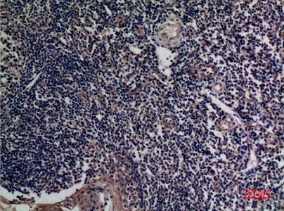 Fig.3. Immunohistochemical analysis of paraffin-embedded human-tonsils, antibody was diluted at 1:100.