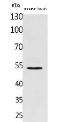 Fig.1. Western Blot analysis of Mouse brain cells using CPE Polyclonal Antibody. Secondary antibody (catalog#: A21020) was diluted at 1:20000.