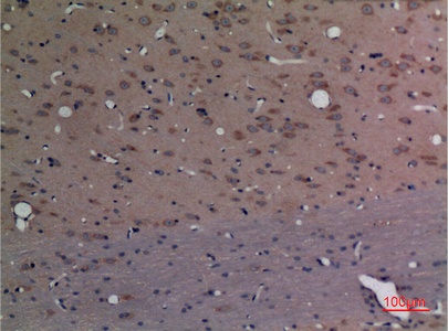 Fig.2. Immunohistochemical analysis of paraffin-embedded rat-brain, antibody was diluted at 1:100.