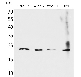 Fig. Western Blot analysis of 293, HepG2,  PC-3, M21 cells using FGF-6 Polyclonal Antibody. Secondary antibody (catalog#: A21020) was diluted at 1:20000.
