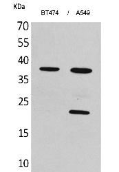 Fig. Western Blot analysis of BT474, A549 cells using IFN-α1 Polyclonal Antibody. Secondary antibody (catalog#: A21020) was diluted at 1:20000.