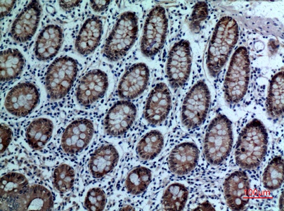 Fig.2. Immunohistochemical analysis of paraffin-embedded human-colon, antibody was diluted at 1:100.