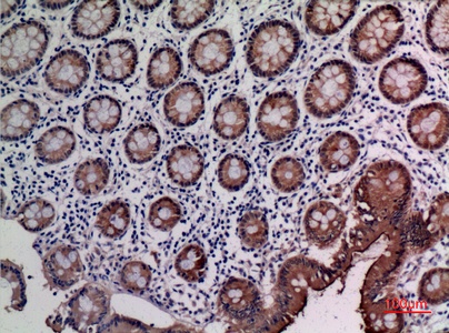 Fig.3. Immunohistochemical analysis of paraffin-embedded human-colon, antibody was diluted at 1:100.