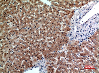 Fig.5. Immunohistochemical analysis of paraffin-embedded human-liver, antibody was diluted at 1:100.