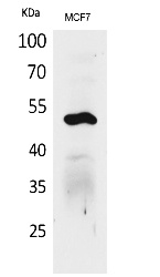 Fig.1. Western Blot analysis of MCF7 cells using Cytokeratin 14 Polyclonal Antibody. Secondary antibody (catalog#: A21020) was diluted at 1:20000.