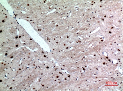 Fig.2. Immunohistochemical analysis of paraffin-embedded rat-brain, antibody was diluted at 1:100.