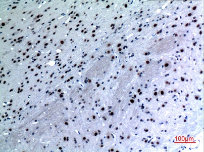 Fig.3. Immunohistochemical analysis of paraffin-embedded rat-brain, antibody was diluted at 1:100.