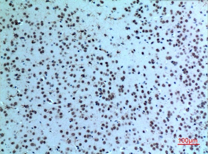 Fig.5. Immunohistochemical analysis of paraffin-embedded Mouse-brain, antibody was diluted at 1:100.