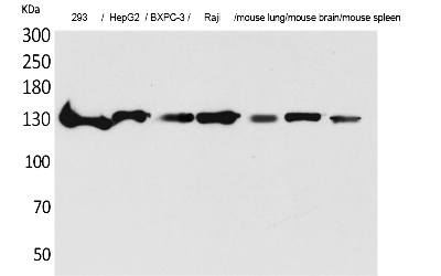 Fig.1. Western Blot analysis of 293, HepG2,  BXPC-3, Raji, Mouse lung, Mouse brain, Mouse spleen cells using IL-16 Polyclonal Antibody. Secondary antibody (catalog#: A21020) was diluted at 1:20000.