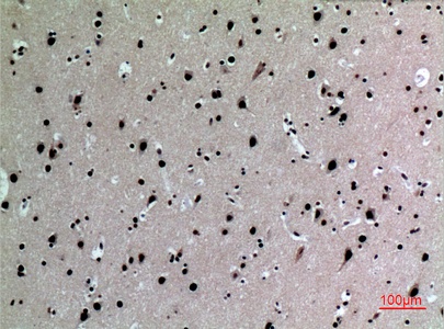 Fig.2. Immunohistochemical analysis of paraffin-embedded human-brain, antibody was diluted at 1:100.