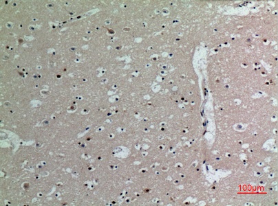 Fig.3. Immunohistochemical analysis of paraffin-embedded human-brain, antibody was diluted at 1:100.
