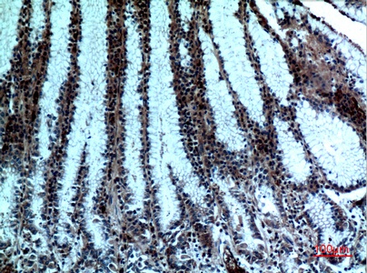 Fig.4. Immunohistochemical analysis of paraffin-embedded human-stomach, antibody was diluted at 1:100.
