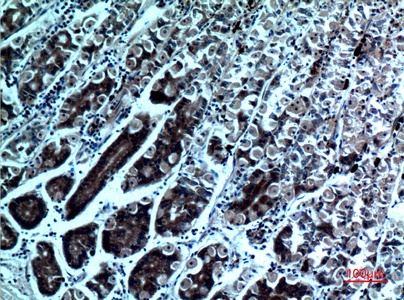 Fig.5. Immunohistochemical analysis of paraffin-embedded human-stomach, antibody was diluted at 1:100.