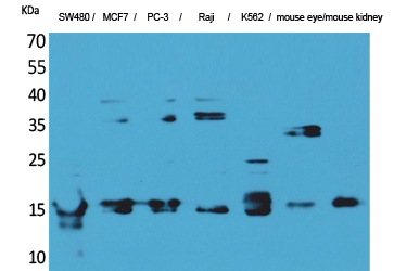 Fig.1. Western Blot analysis of SW480, MCF7, PC-3, Raji, K562,  Mouse eye, Mouse kidney cells using MK Polyclonal Antibody. Secondary antibody (catalog#: A21020) was diluted at 1:20000.