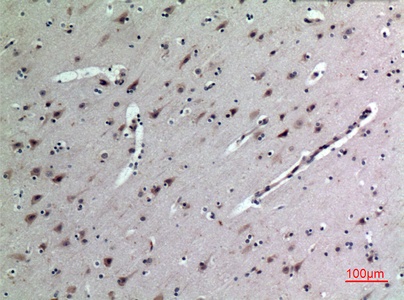 Fig.2. Immunohistochemical analysis of paraffin-embedded human-brain, antibody was diluted at 1:100.
