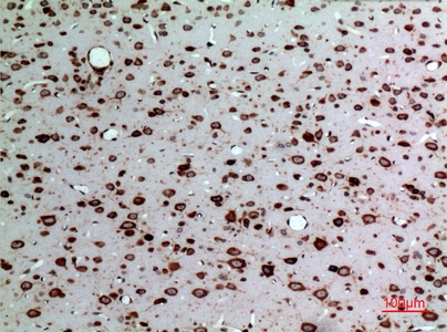 Fig.3. Immunohistochemical analysis of paraffin-embedded rat-brain, antibody was diluted at 1:100.