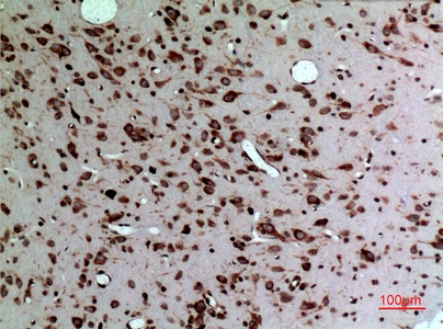 Fig.4. Immunohistochemical analysis of paraffin-embedded rat-brain, antibody was diluted at 1:100.