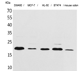 Fig.1. Western Blot analysis of SW480, MCF-7, HL-60, BT474, Mouse colon cells using FGF-20 Polyclonal Antibody. Secondary antibody (catalog#: A21020) was diluted at 1:20000.