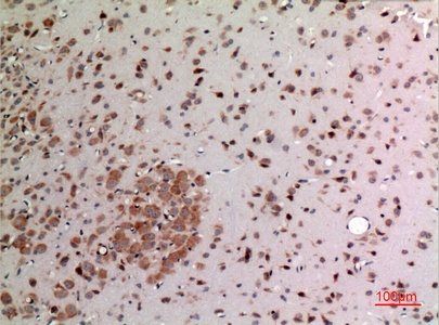 Fig.3. Immunohistochemical analysis of paraffin-embedded rat-brain, antibody was diluted at 1:100.
