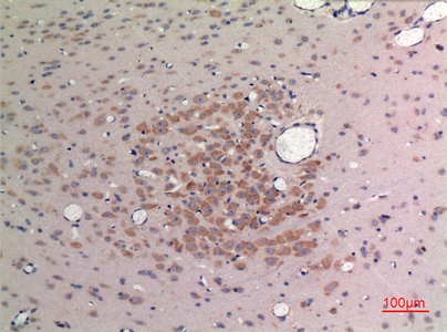 Fig.2. Immunohistochemical analysis of paraffin-embedded rat-brain, antibody was diluted at 1:100.